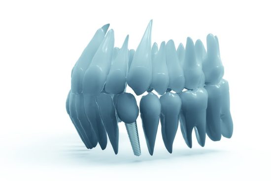 découvrez tout sur l’implant cochléaire : fonctionnement, avantages, candidatures et accompagnement pour permettre aux personnes atteintes de surdité profonde de retrouver l’audition. informations, conseils et actualités sur la chirurgie auditive.